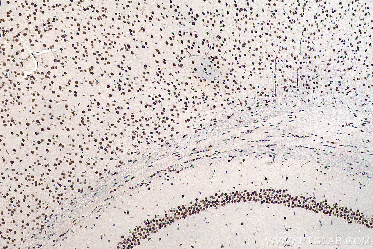 IHC staining of mouse brain using 60082-1-Ig