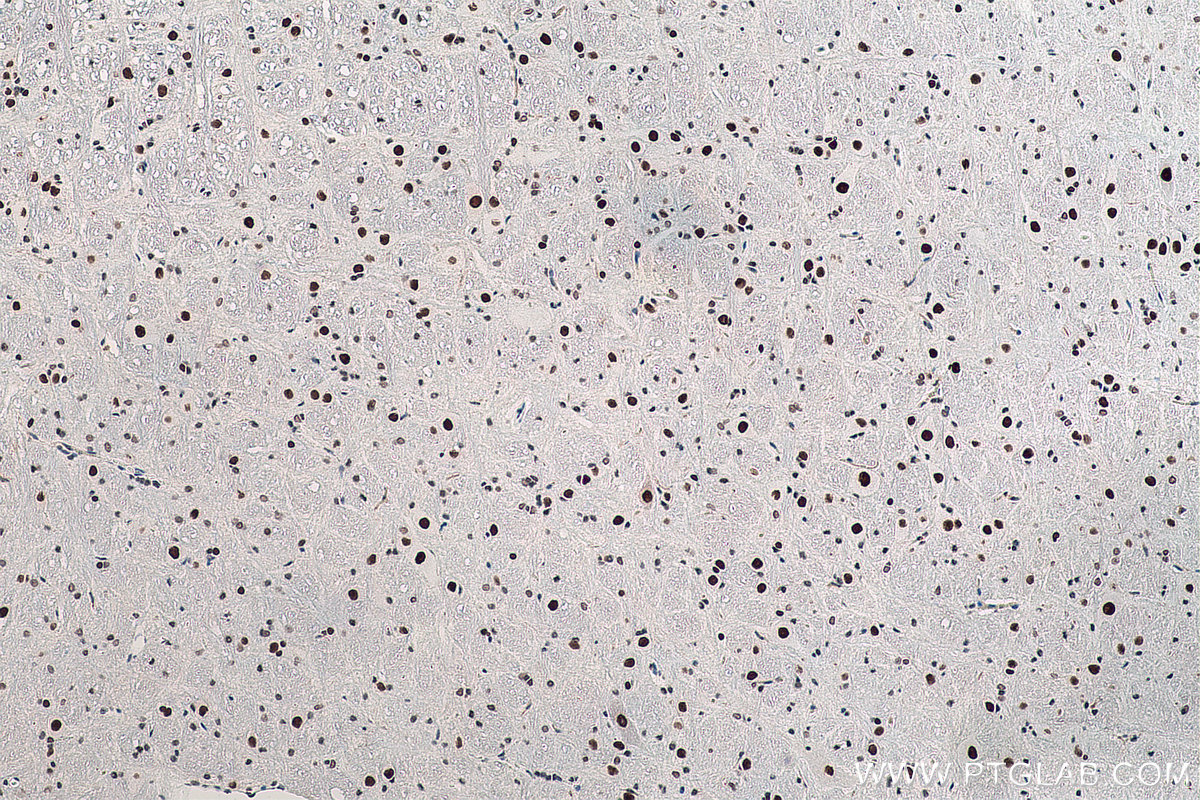 IHC staining of rat cerebellum using 60082-1-Ig