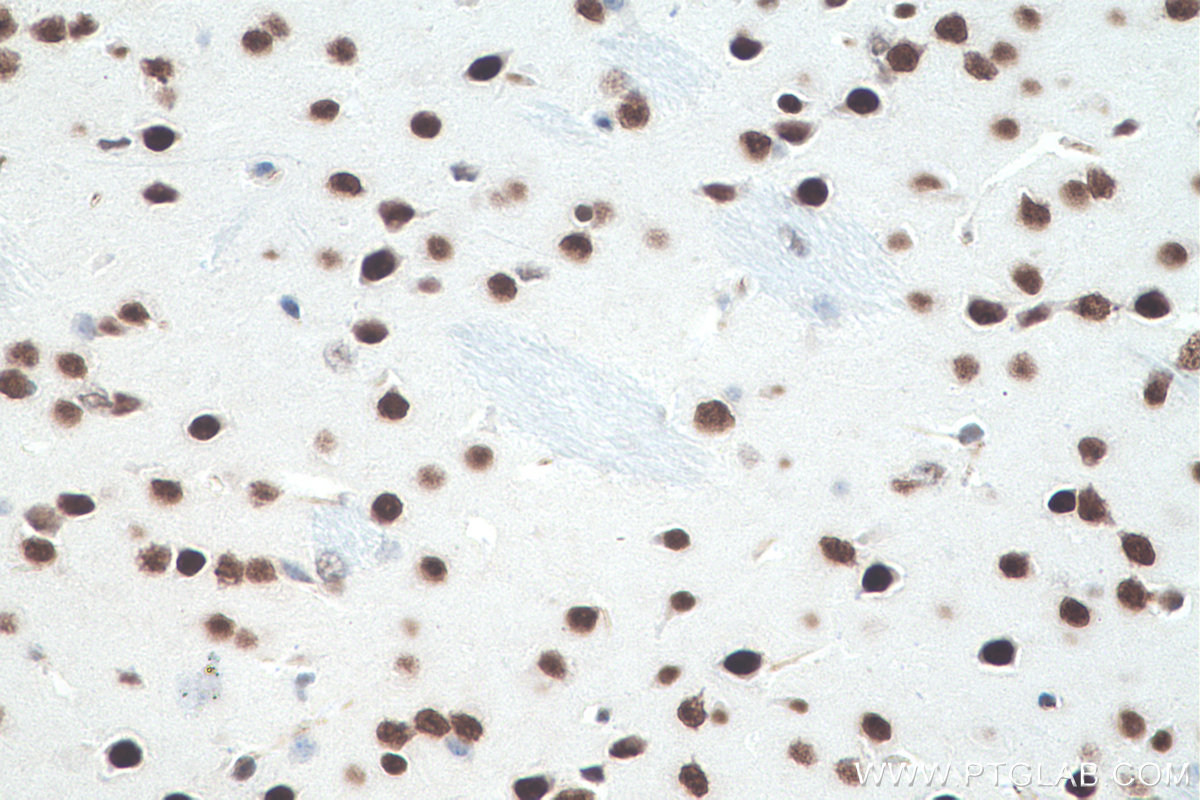 IHC staining of mouse brain using 60082-1-Ig (same clone as 60082-1-PBS)