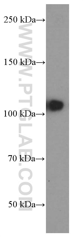 WB analysis of MCF-7 using 60082-1-Ig (same clone as 60082-1-PBS)
