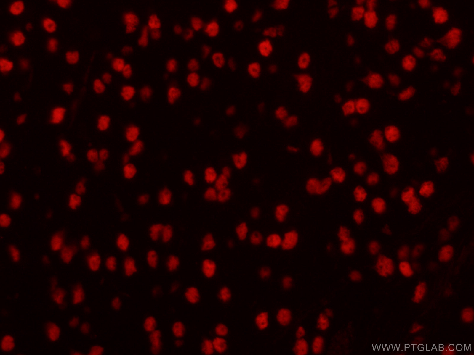 IF Staining of mouse brain using CL594-60082