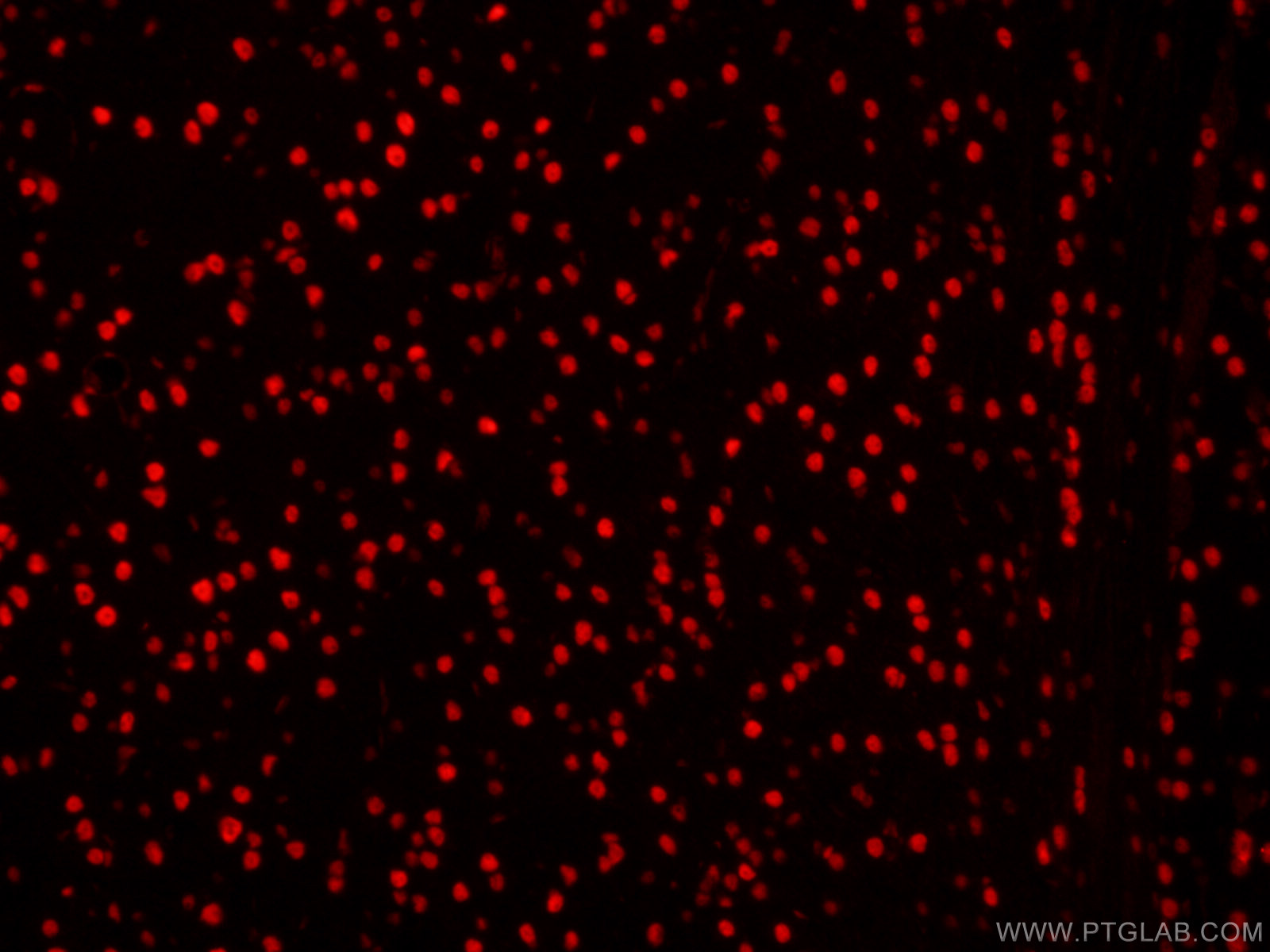 IF Staining of mouse brain using CL594-60082