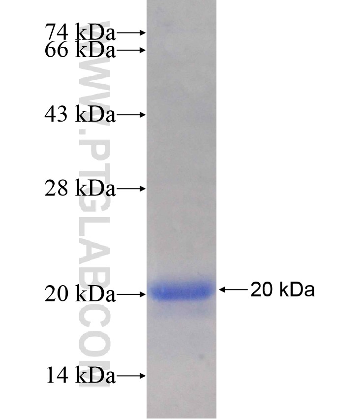 DACH2 fusion protein Ag18186 SDS-PAGE DACH2 fusion protein Ag18186 SDS-PAGE