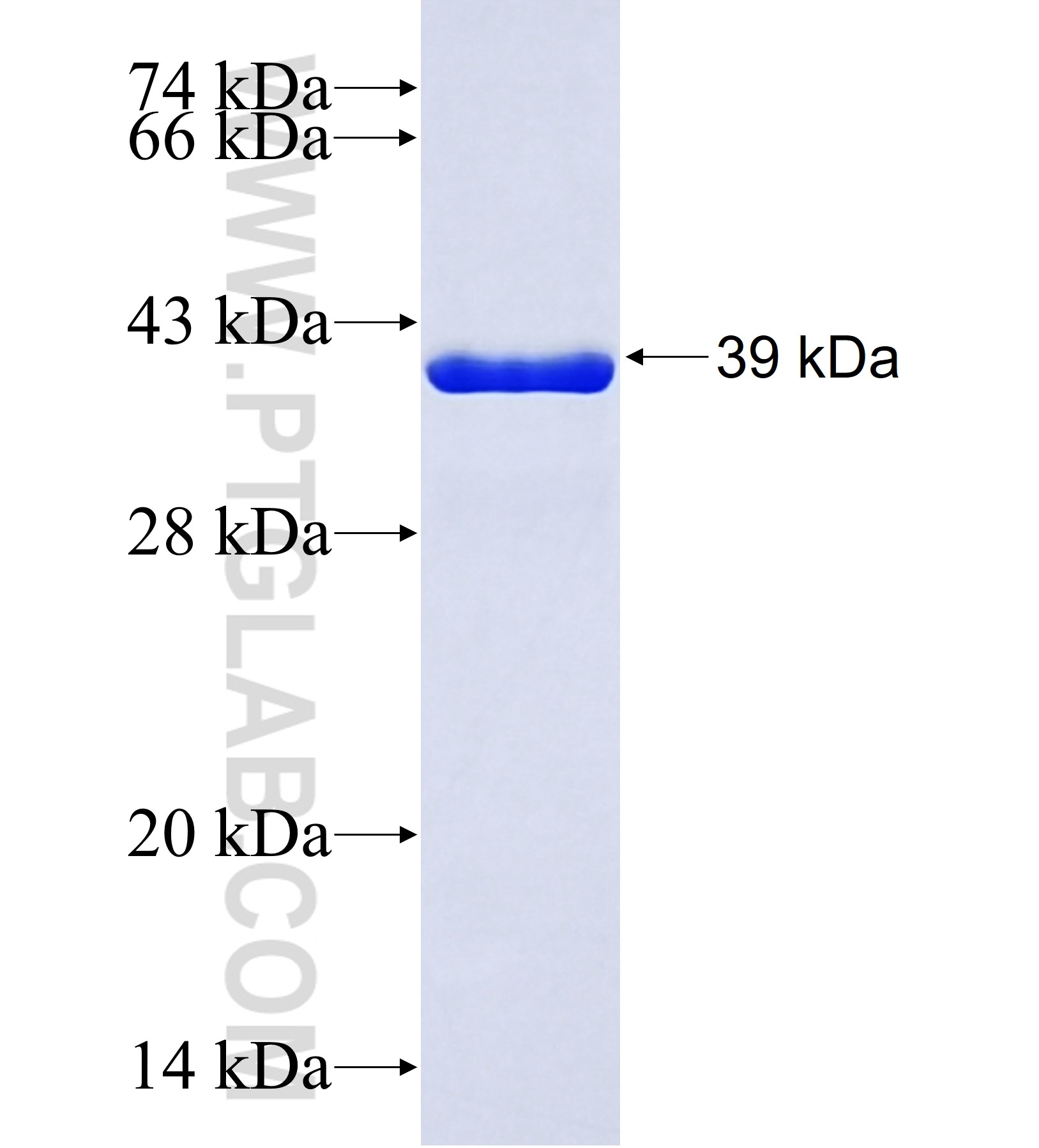 DACT2 fusion protein Ag41977 SDS-PAGE DACT2 fusion protein Ag41977 SDS-PAGE
