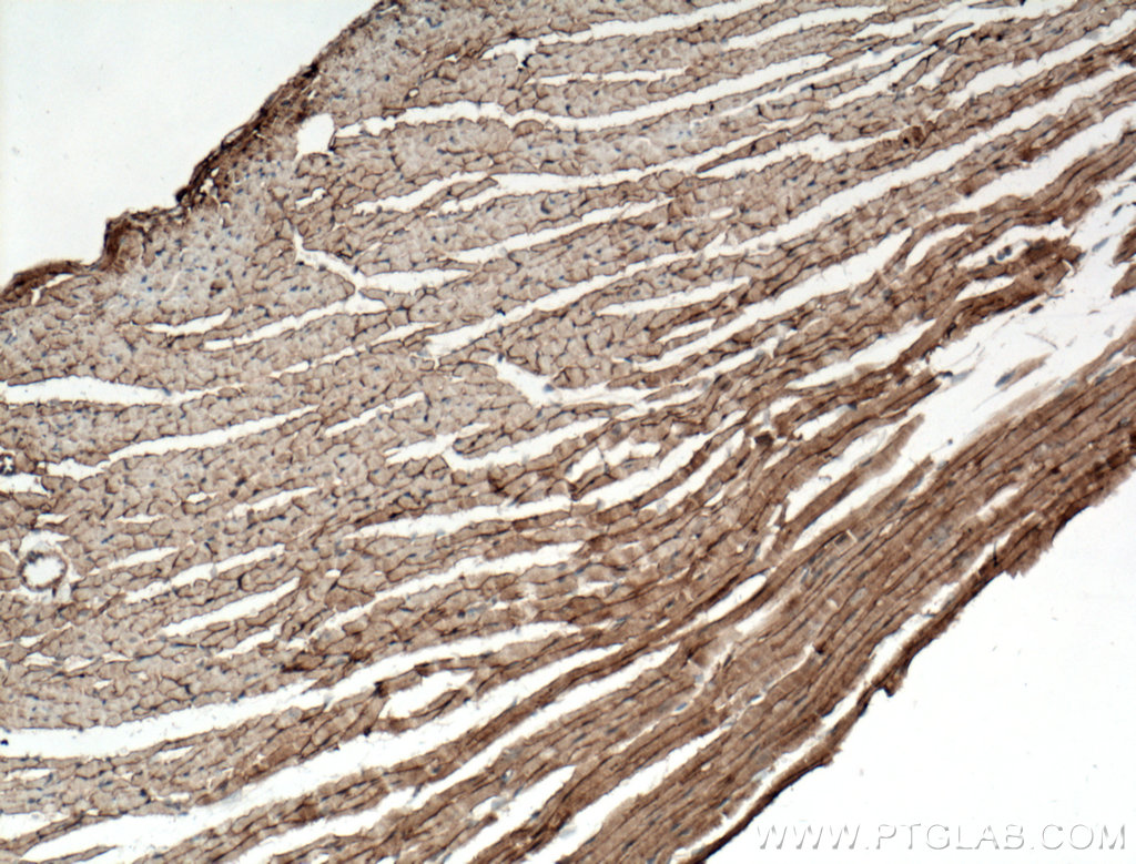 Dystroglycan