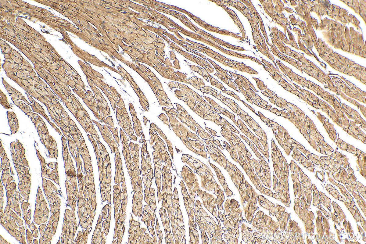 IHC staining of mouse heart using 11017-1-AP