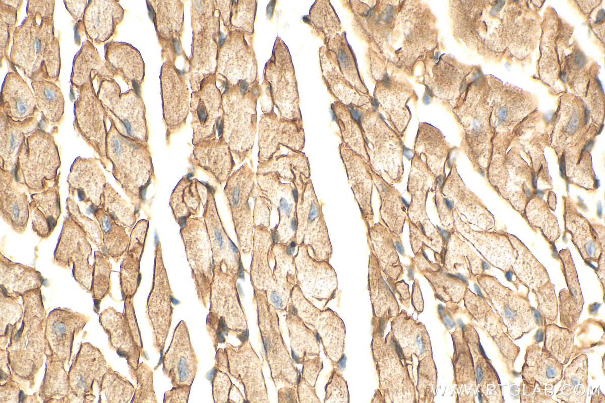 IHC staining of mouse heart using 11017-1-AP