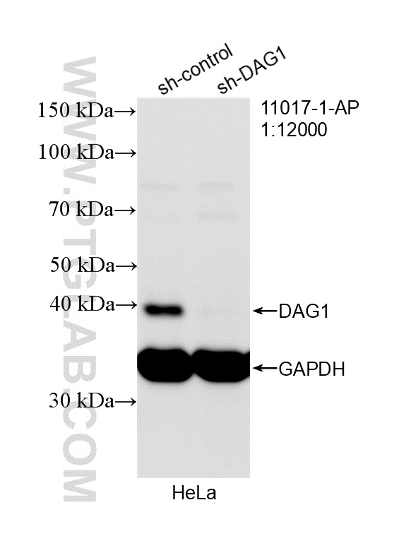 WB analysis of HeLa using 11017-1-AP WB analysis of HeLa using 11017-1-AP