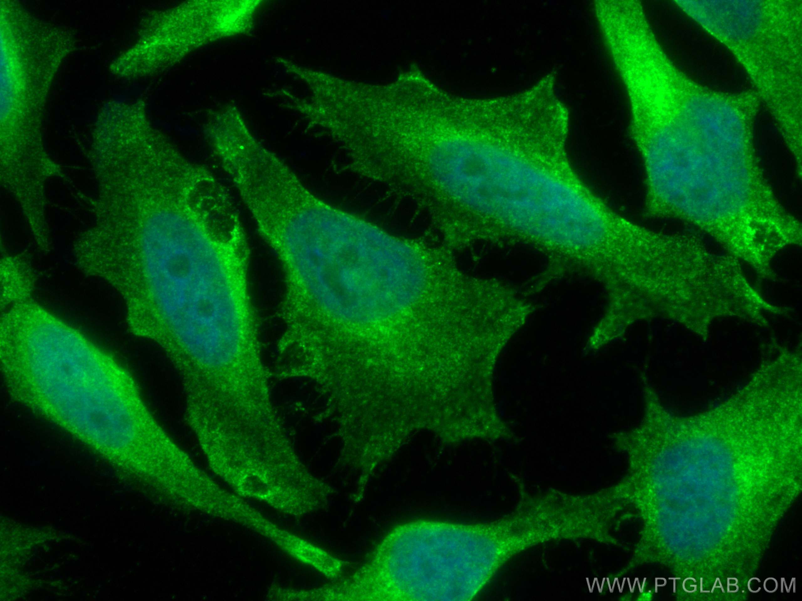 IF Staining of HeLa using 66735-1-Ig