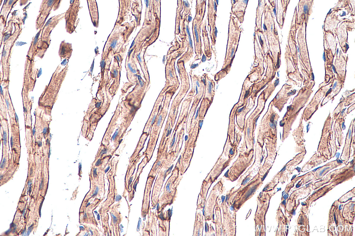 IHC staining of mouse heart using 66735-1-Ig