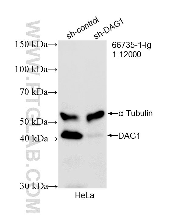 WB analysis of HeLa using 66735-1-Ig WB analysis of HeLa using 66735-1-Ig