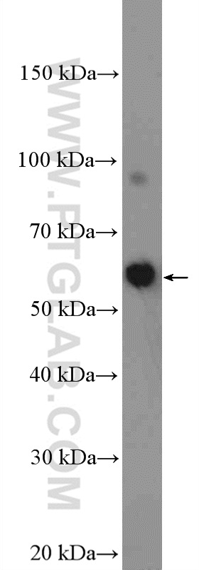 WB analysis of K-562 using 26294-1-AP