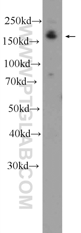 DAPK1 Polyclonal antibody