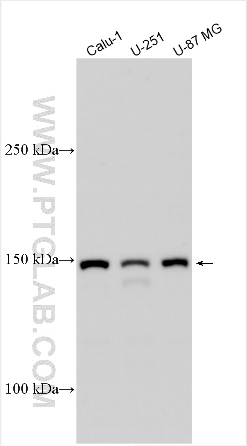 WB analysis using 25136-1-AP