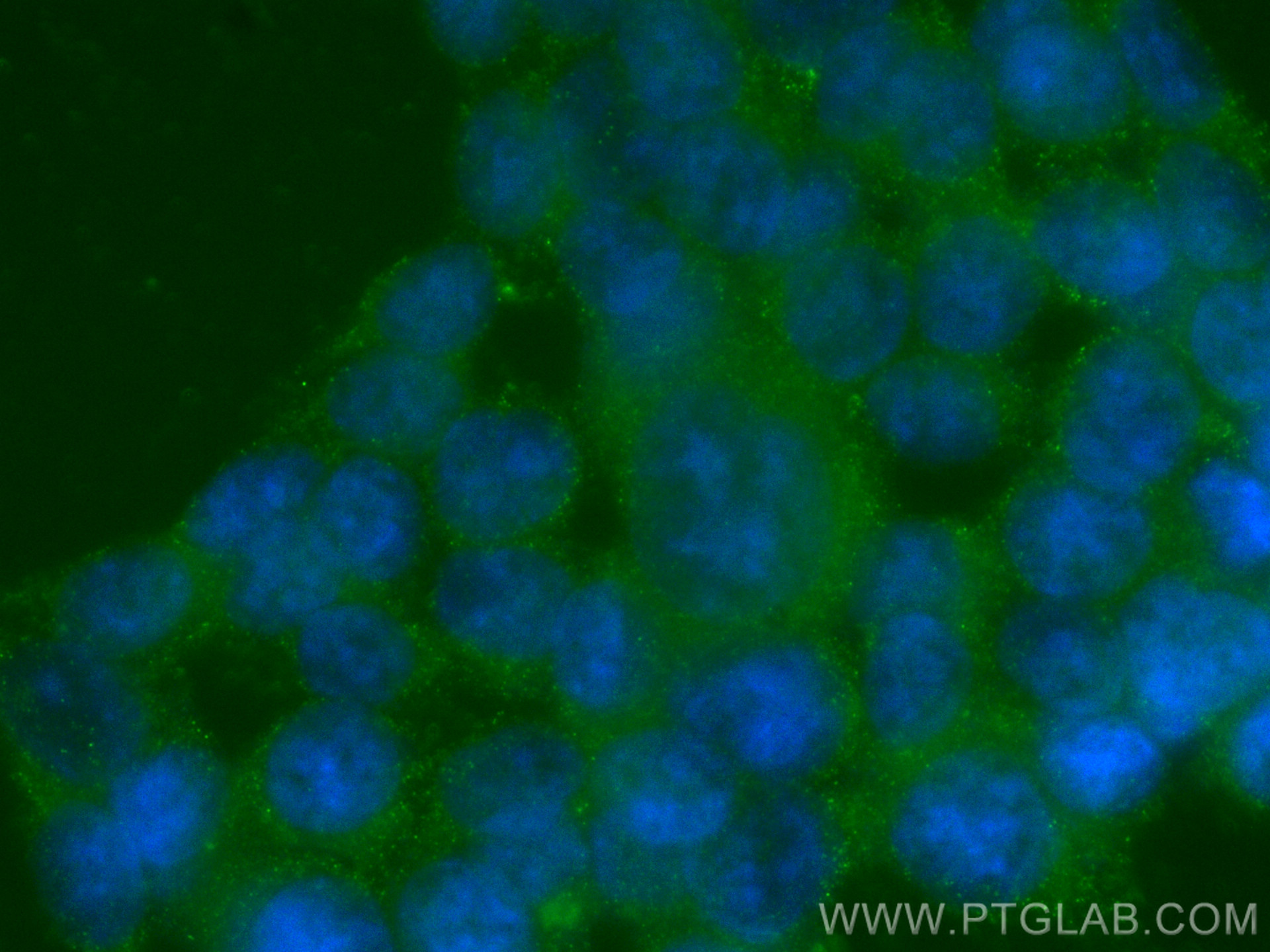IF Staining of HCT 116 using 67815-1-Ig