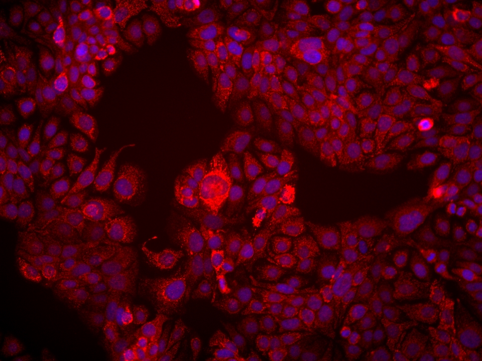 IF Staining of HT-1376 using 67815-1-Ig
