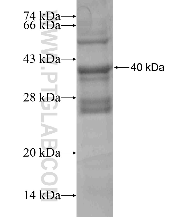 DAPK2 fusion protein Ag18105 SDS-PAGE