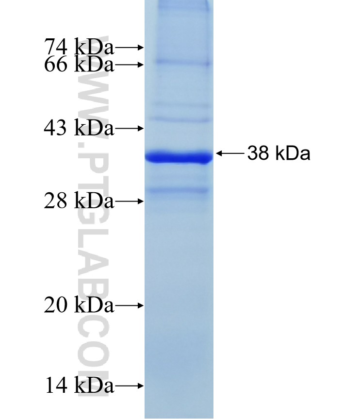 DAPK2 fusion protein Ag18105 SDS-PAGE DAPK2 fusion protein Ag18105 SDS-PAGE
