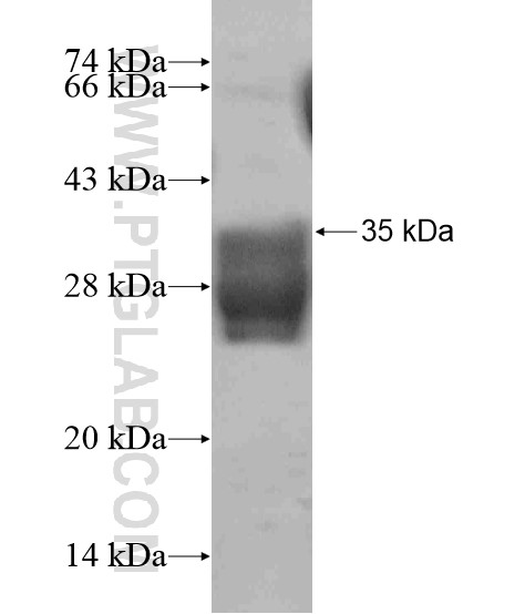 DAPL1 fusion protein Ag18805 SDS-PAGE DAPL1 fusion protein Ag18805 SDS-PAGE