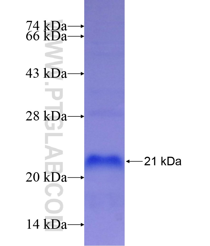 DARC fusion protein Ag17470 SDS-PAGE DARC fusion protein Ag17470 SDS-PAGE