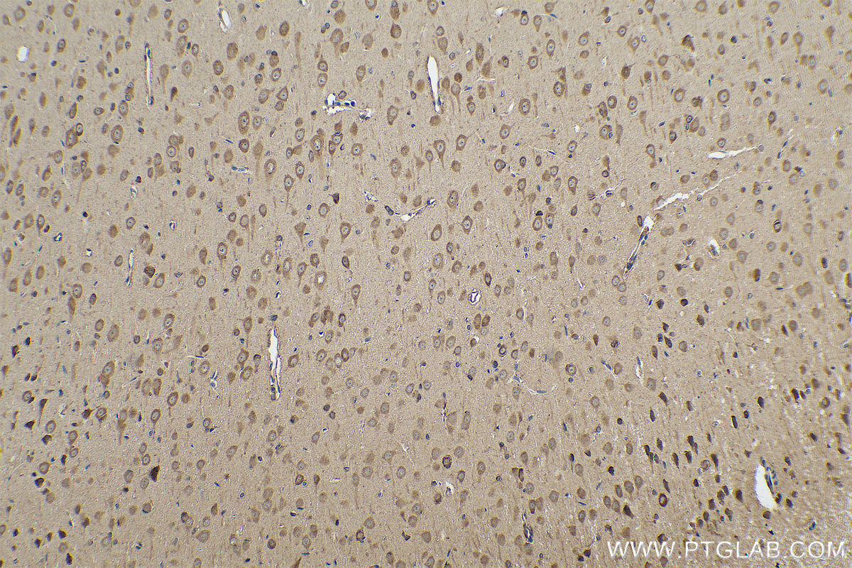 IHC staining of rat brain using 14989-1-AP