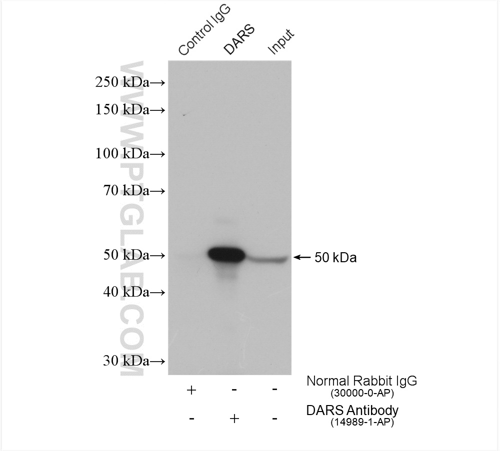 IP experiment of HeLa using 14989-1-AP (same clone as 14989-1-PBS)