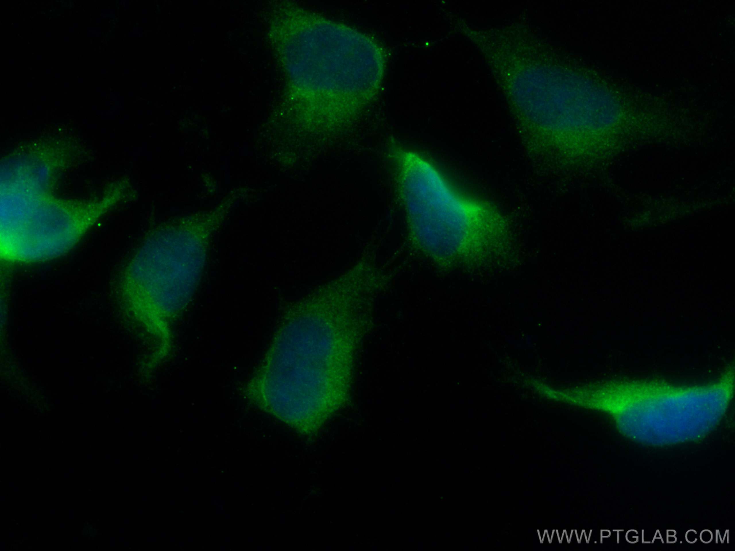 IF Staining of SH-SY5Y using 67930-1-Ig (same clone as 67930-1-PBS)