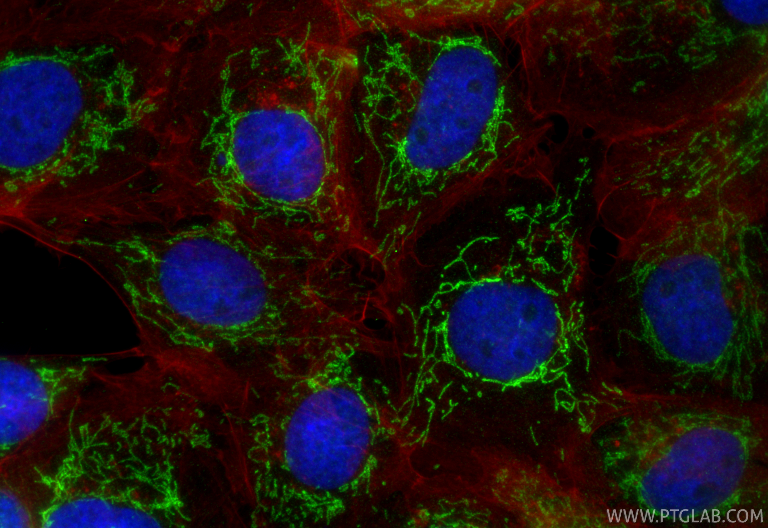 Immunofluorescent analysis of (4% PFA) fixed A431 cells using DARS2 antibody (RMX00040) at dilution of 1:200 and CoraLite®488-Conjugated Goat Anti-Rabbit IgG(H+L) (<a class='green' href='/productredirect?CatalogNo=SA00013-2' target='_blank'>SA00013-2</a>), CL594-Phalloidin (red). IF Staining of A431 using RMX00040