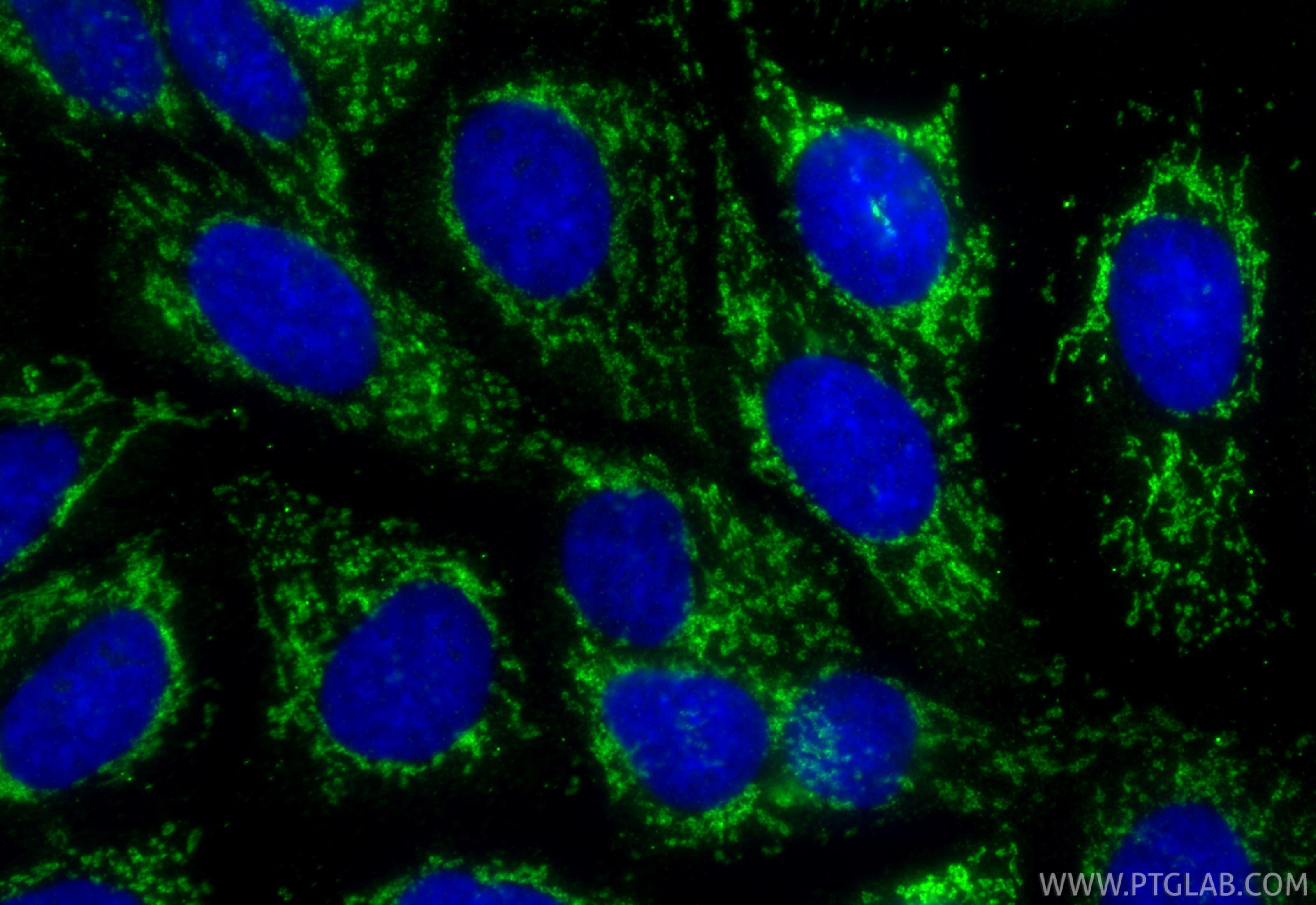 Immunofluorescent analysis of (-20°C Methanol) fixed A431 cells using DARS2 antibody (RMX00040) at dilution of 1:200 and CoraLite®488-Conjugated Goat Anti-Rabbit IgG(H+L) (<a class='green' href='/productredirect?CatalogNo=SA00013-2' target='_blank'>SA00013-2</a>). IF Staining of A431 using RMX00040