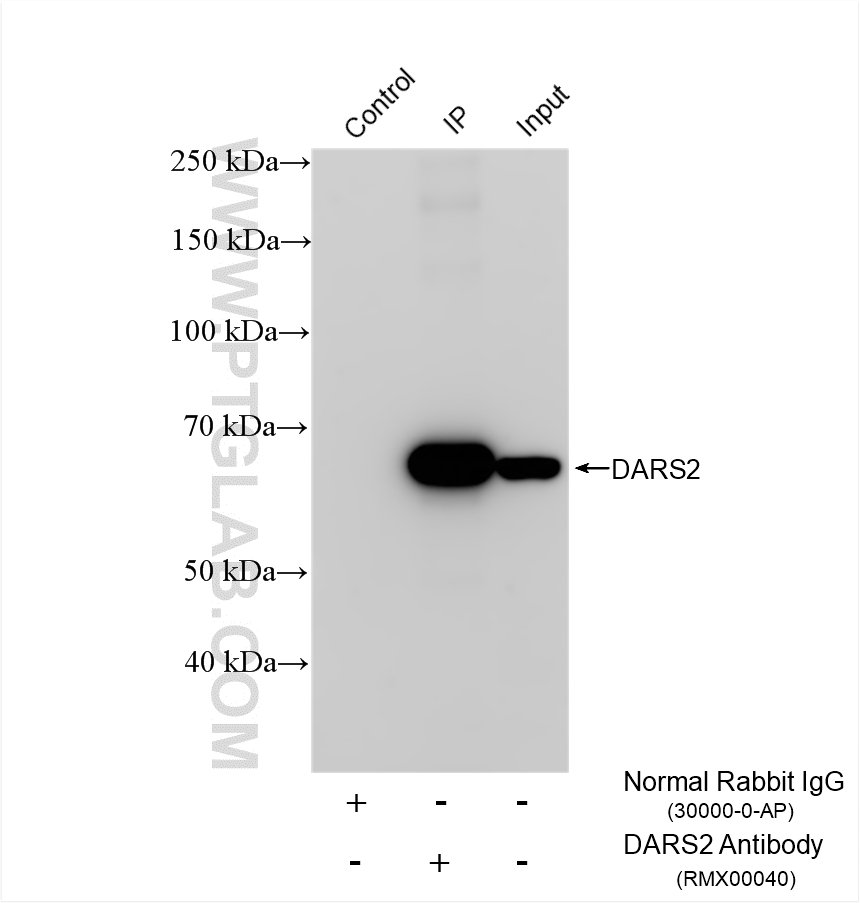 IP result of anti-DARS2 (IP:RMX00040, 4ug; Detection:RMX00040 1:10000) with A549 cells lysate 920 ug. IP experiment of A549 using RMX00040