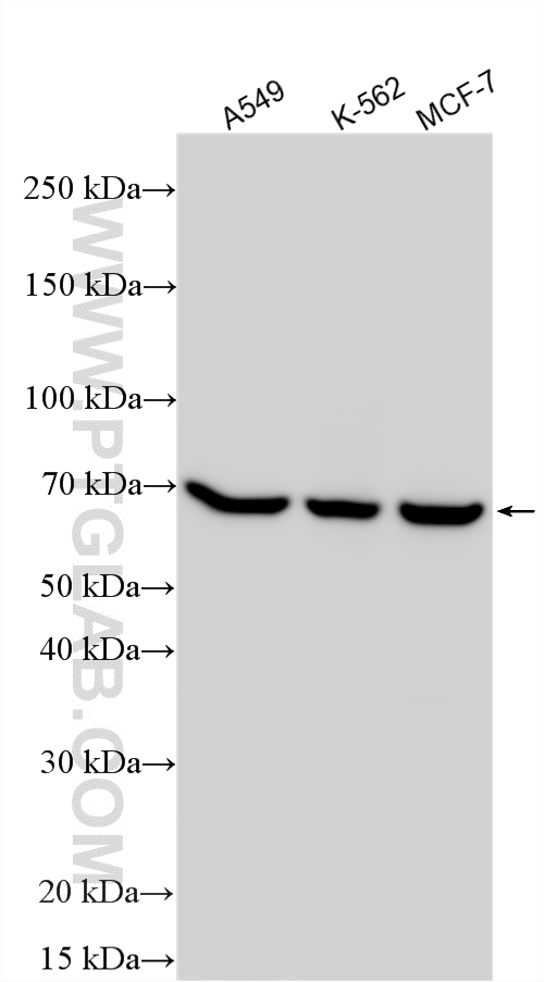 Various lysates were subjected to SDS PAGE followed by western blot with RMX00040 (DARS2 antibody) at dilution of 1:10000 incubated at room temperature for 1.5 hours. WB analysis using RMX00040