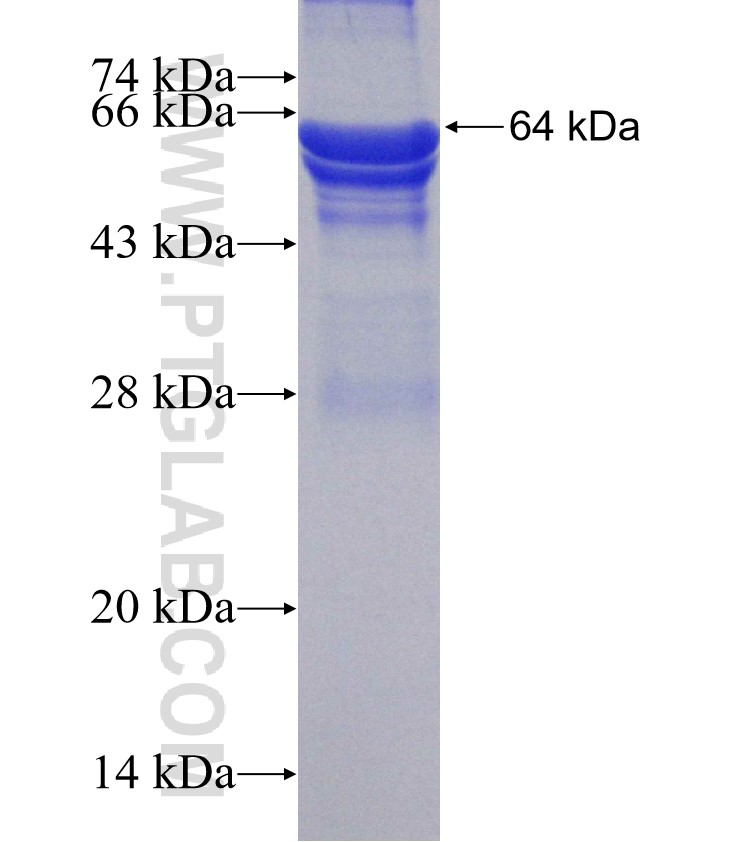 DARS2 fusion protein Ag4809 SDS-PAGE