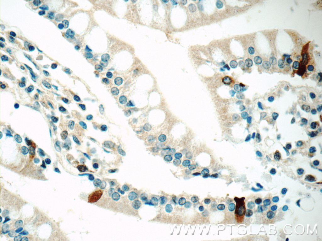 IHC staining of human small intestine using 20849-1-AP