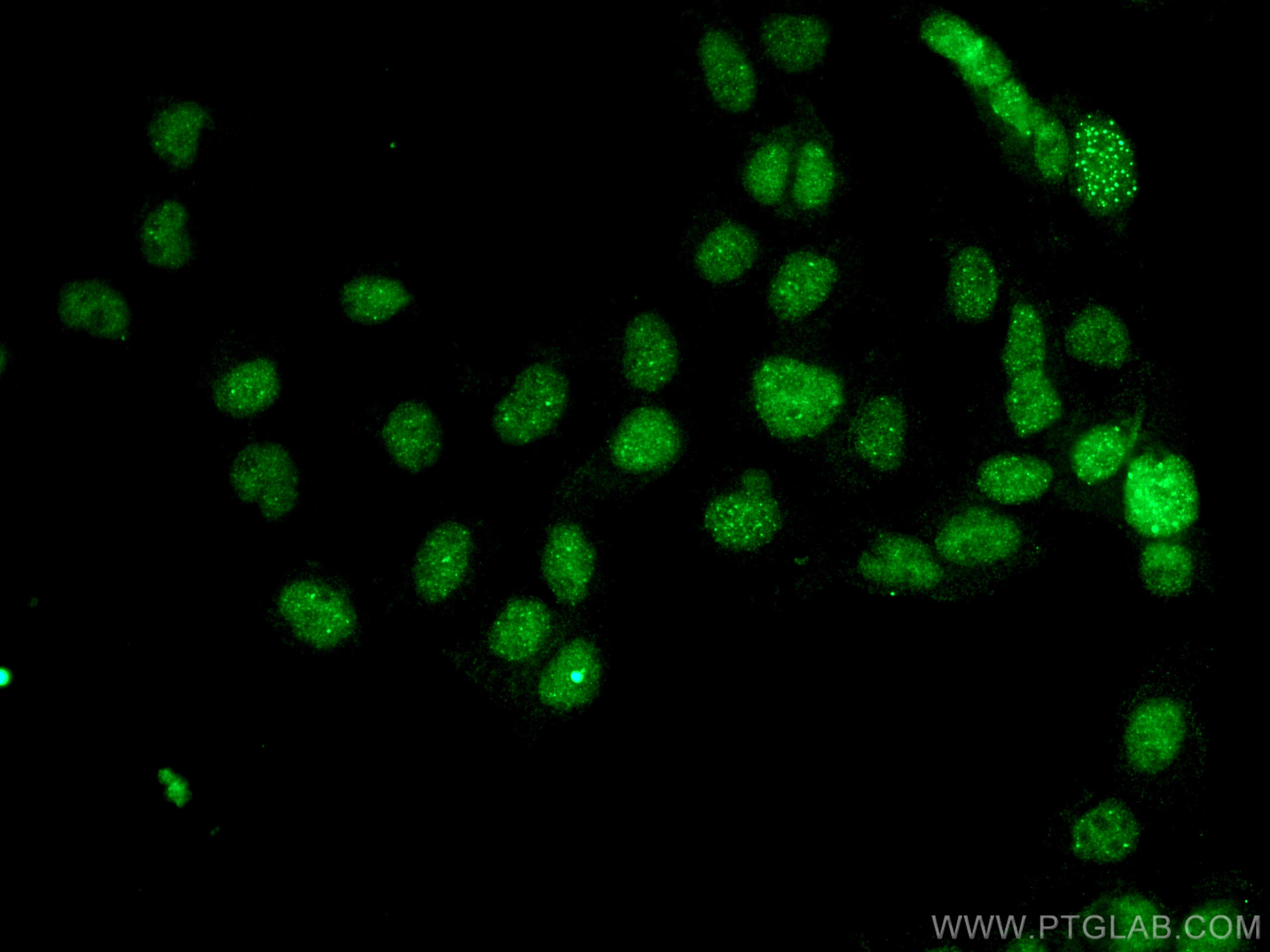 IF Staining of A431 using 67879-1-Ig