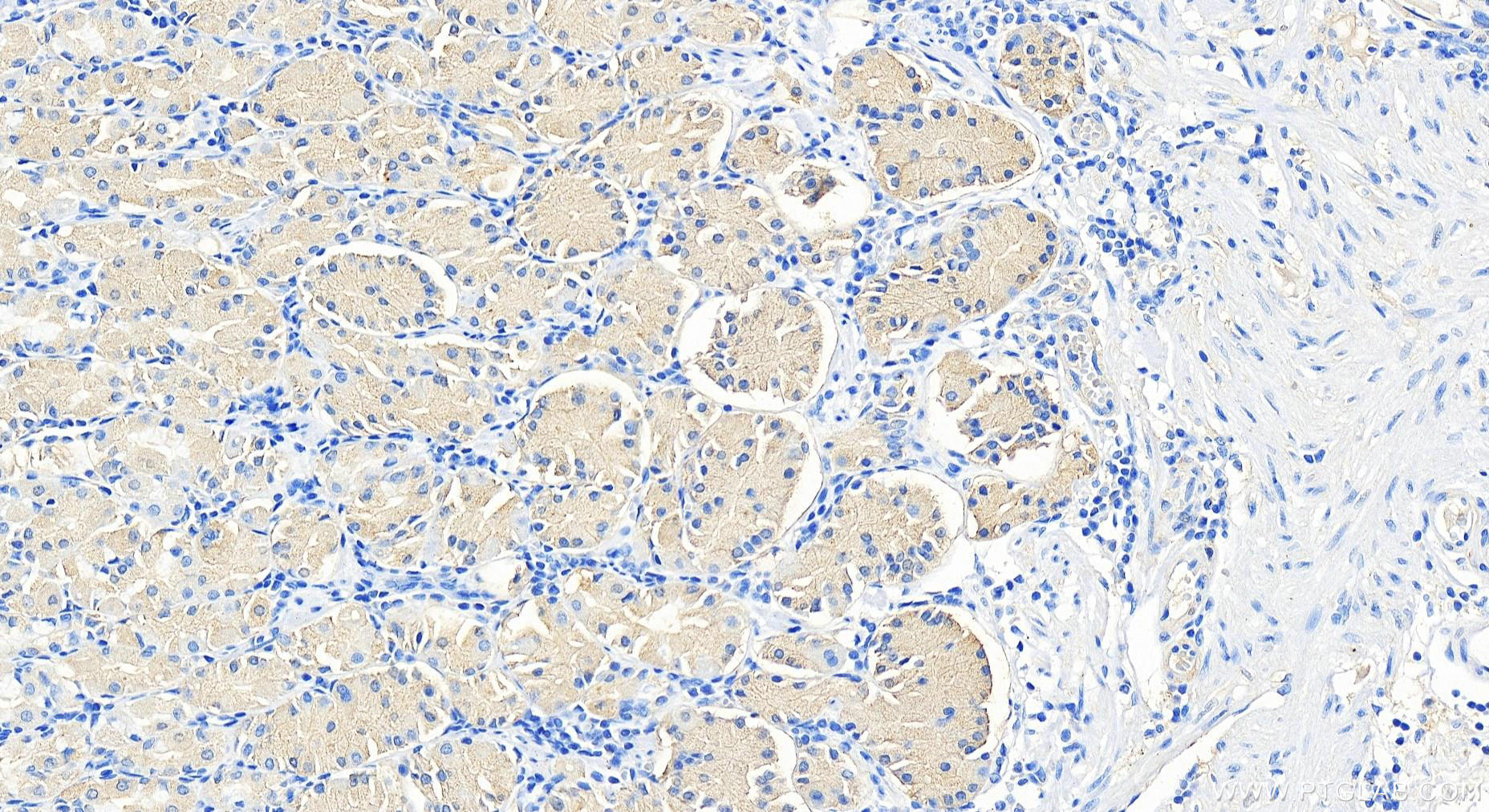IHC staining of human stomach using 14065-1-AP