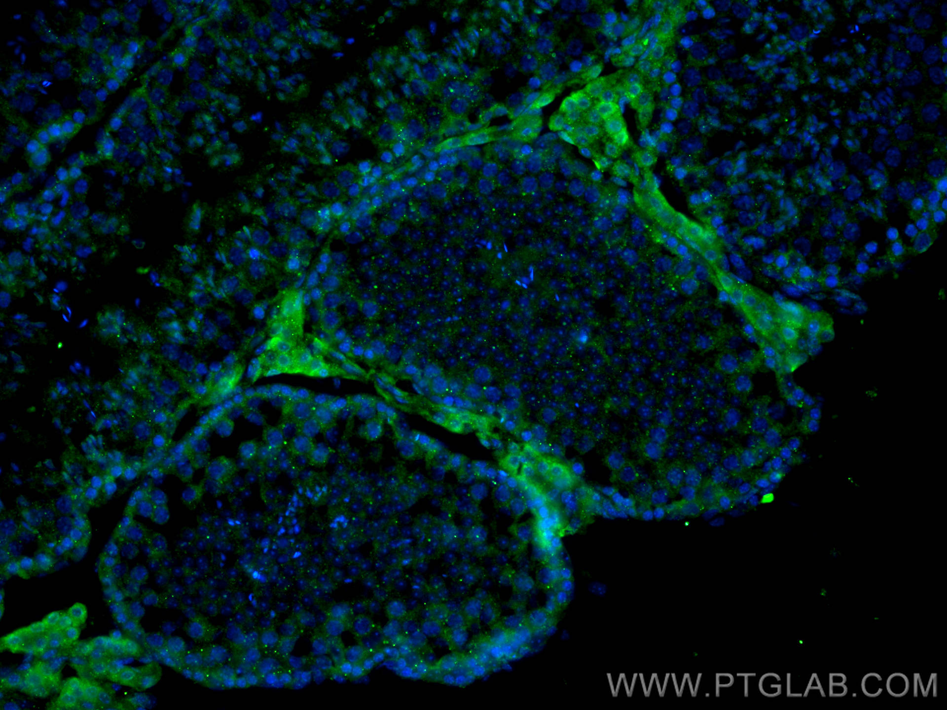 IF Staining of mouse testis using 12633-1-AP