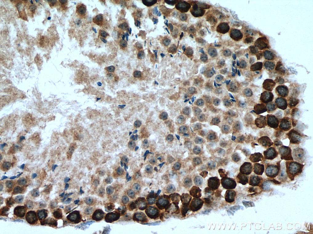 IHC staining of mouse testis using 12633-1-AP