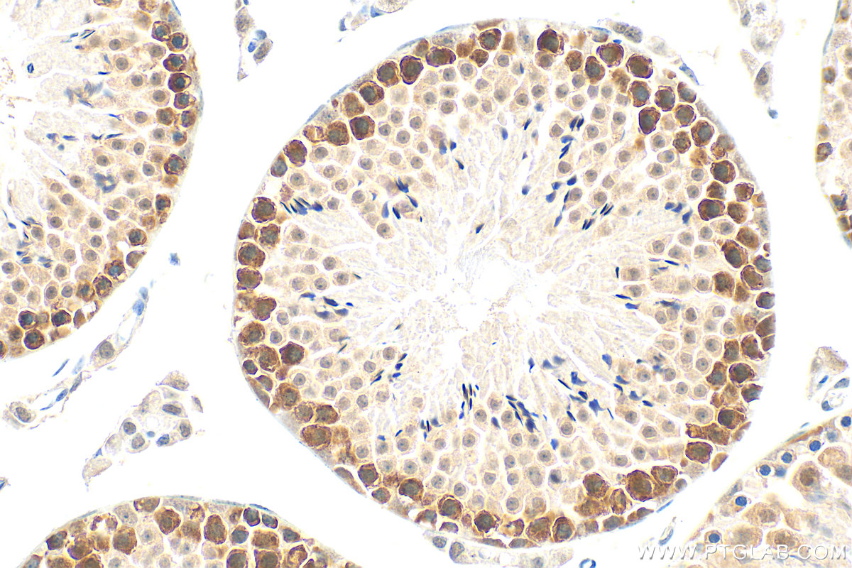 IHC staining of mouse testis using 12633-1-AP