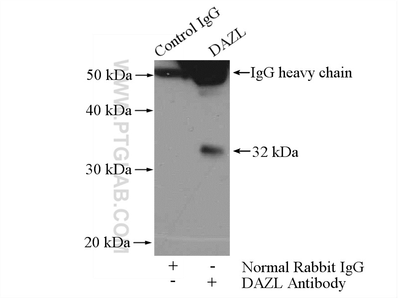 IP experiment of mouse testis using 12633-1-AP