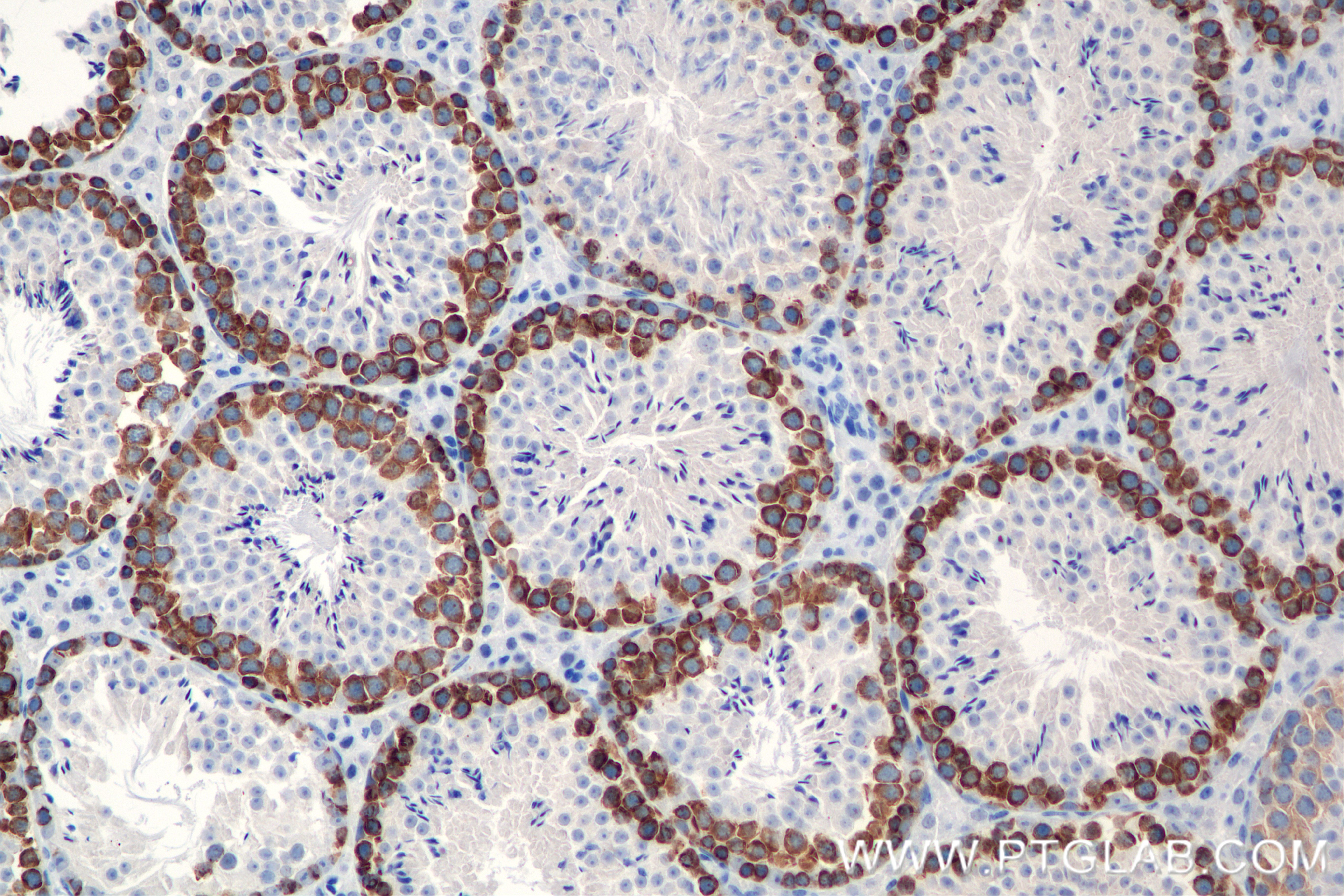 IHC staining of mouse testis using 86344-3-RR