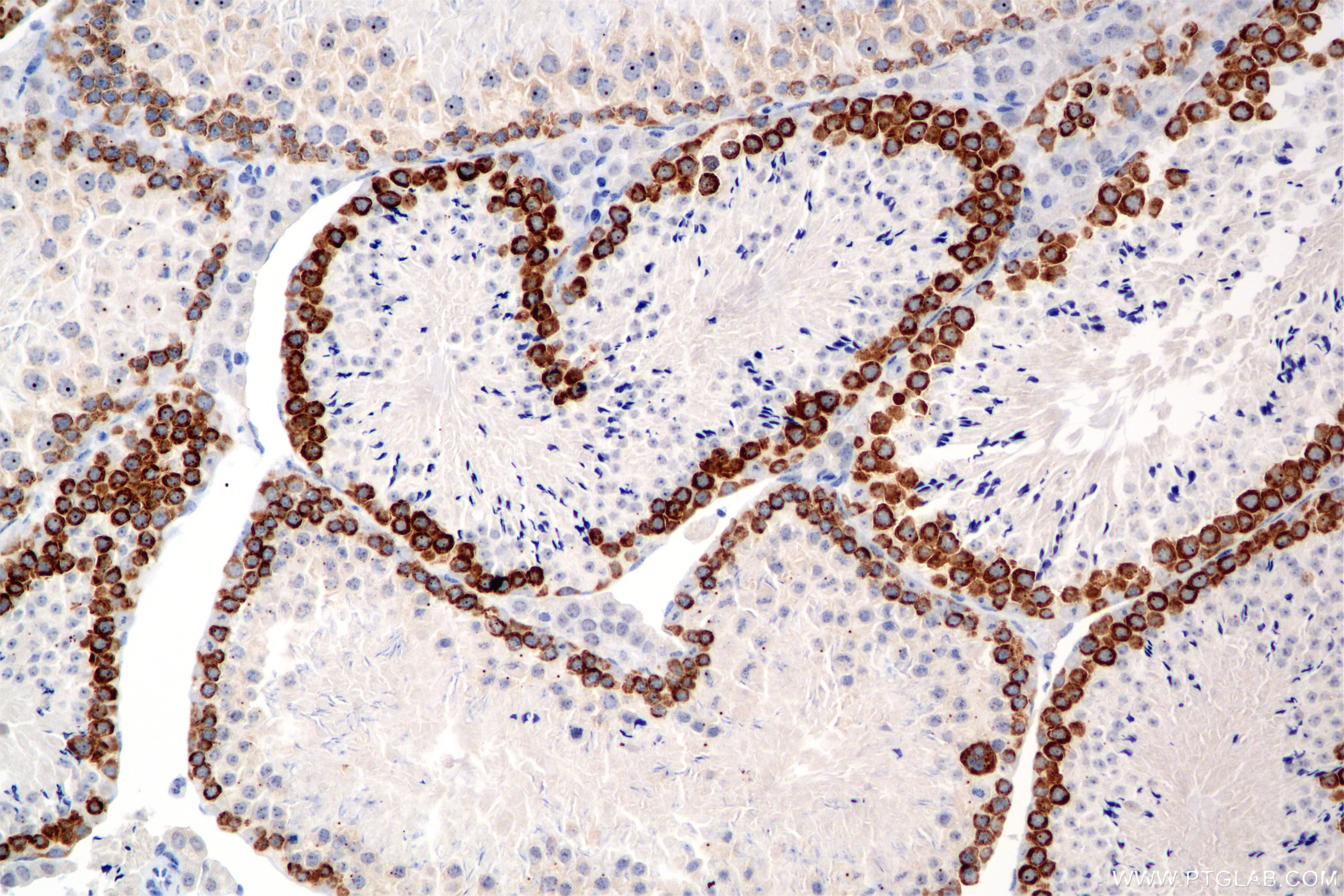 IHC staining of mouse testis using 86344-3-RR
