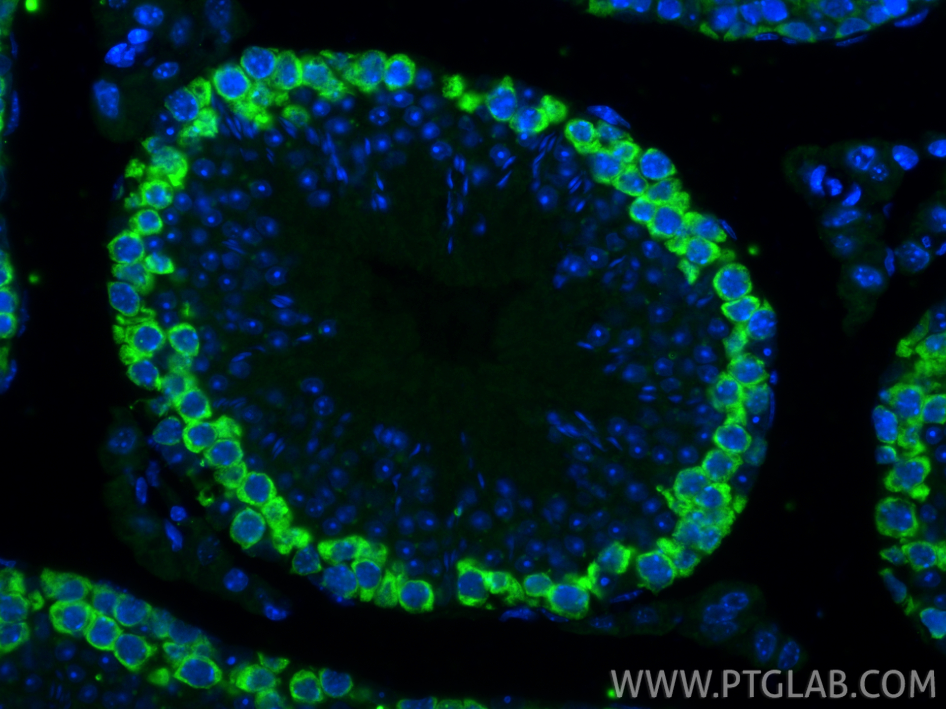 IF Staining of mouse testis using RMX00077 IF Staining of mouse testis using RMX00077