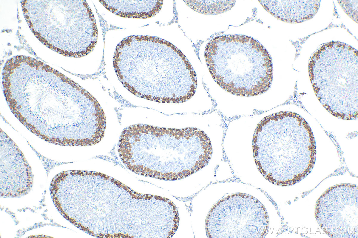 IHC staining of rat testis using RMX00077 IHC staining of rat testis using RMX00077