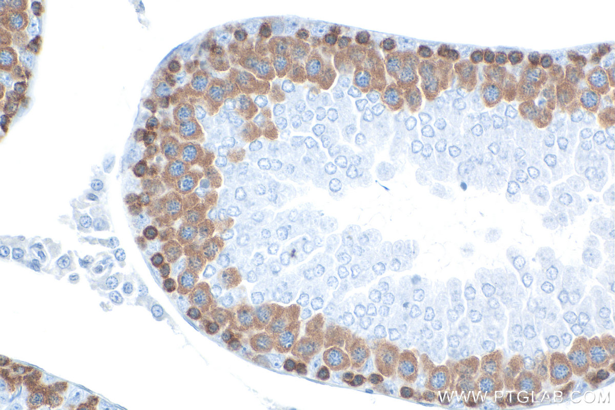 IHC staining of rat testis using RMX00077 IHC staining of rat testis using RMX00077