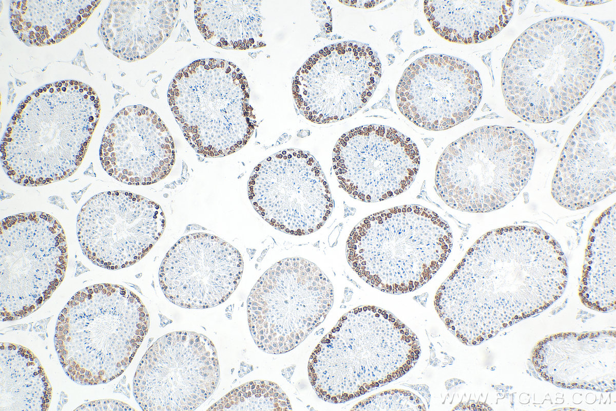 IHC staining of mouse testis using RMX00077 IHC staining of mouse testis using RMX00077