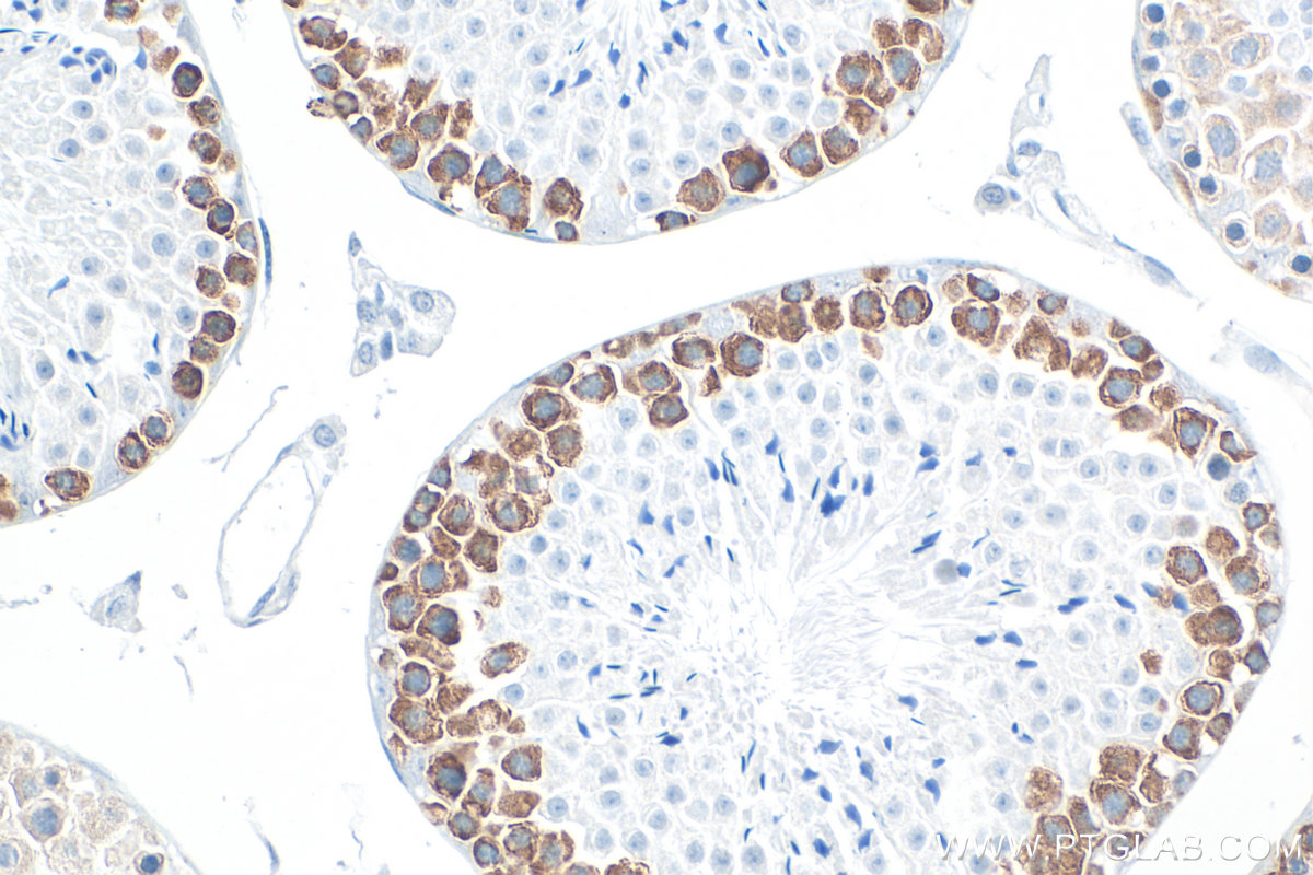 IHC staining of mouse testis using RMX00077 IHC staining of mouse testis using RMX00077