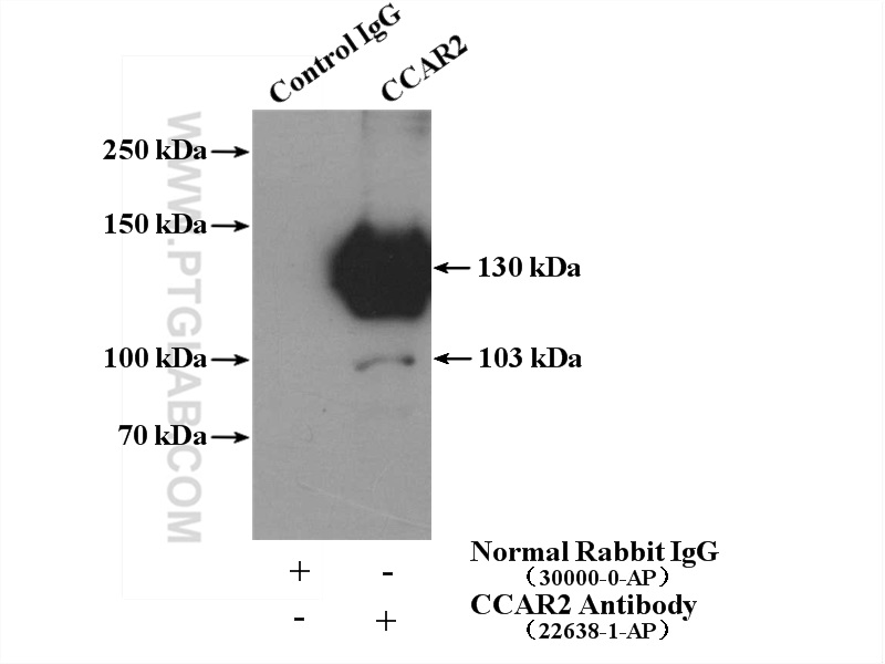 IP experiment of mouse brain using 22638-1-AP