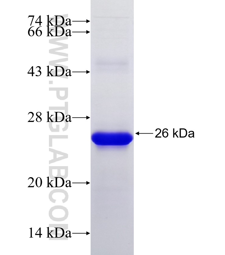 DBF4 fusion protein Ag30180 SDS-PAGE DBF4 fusion protein Ag30180 SDS-PAGE