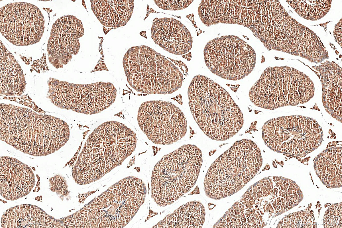 IHC staining of mouse testis using 26214-1-AP