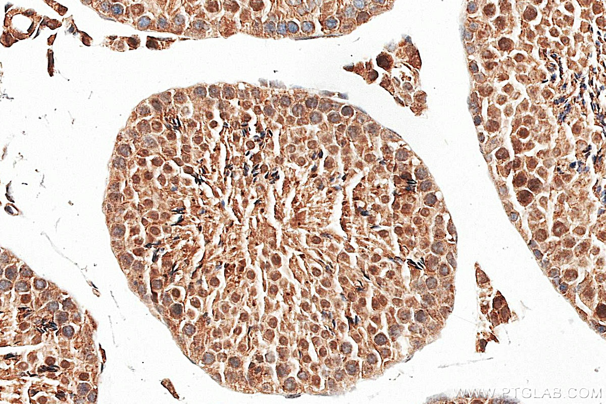 IHC staining of mouse testis using 26214-1-AP